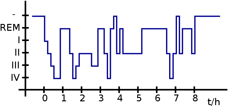 Hypnogramm, Typischer Schlafzyklus